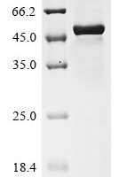 Human Interleukin-27 subunit beta (Ebi3),Partial Recombinant Protein - BioCrest Sci