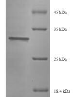 Saccharomyces cerevisiae Eukaryotic translation initiation factor 5A-1 (HYP2) Recombinant Protein - BioCrest Sci