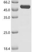 Bartonella quintana Dihydrolipoyllysine-residue succinyltransferase component of 2-oxoglutarate dehydrogenase complex (sucB) Recombinant Protein - BioCrest Sci