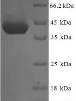 Human Orofacial cleft 1 candidate gene 1 protein (OFCC1), partial Recombinant Protein - BioCrest Sci