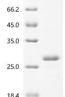 Brucella abortus OmpA-like transmembrane domain Recombinant Protein - BioCrest Sci