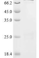 Bacillus thuringiensis subsp. tenebrionis Pesticidal crystal protein Cry3Aa (cry3Aa) Recombinant Protein - BioCrest Sci