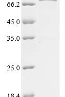 Human Von Hippel-Lindau disease tumor suppressor (VHL),Biotinylated Recombinant Protein - BioCrest Sci