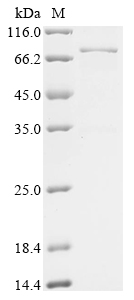 Human Von Hippel-Lindau disease tumor suppressor (VHL),Biotinylated Recombinant Protein, Homo sapiens (Human), E.coli, N-terminal MBP-tagged and C-terminal 6xHis-Avi-tagged, 71.9 kDa, purity >≥ 85% as determined by SDS-PAGE.
