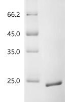 Mouse Versican core protein (Vcan), partial Recombinant Protein - BioCrest Sci