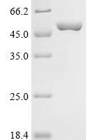 Human Glutaminase kidney isoform, mitochondrial (GLS), partial, Biotinylated Recombinant Protein - BioCrest Sci