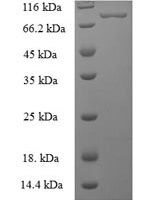 Human Bifunctional polynucleotide phosphatase/kinase (PNKP) Recombinant Protein - BioCrest Sci