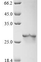 Arabidopsis thaliana Ubiquitin-conjugating enzyme E2 8 (UBC8) Recombinant Protein - BioCrest Sci