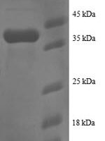 Human Small ribosomal subunit protein eS25 (RPS25) Recombinant Protein - BioCrest Sci