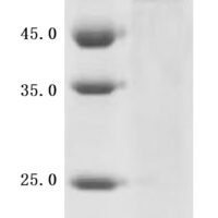 Mouse Disintegrin and metalloproteinase domain-containing protein 9 (Adam9), Partial Recombinant Protein - BioCrest Sci