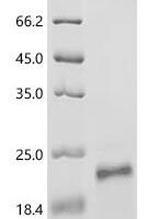 Human papillomavirus 69 Protein E7 (E7) Recombinant Protein - BioCrest Sci