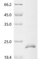 Bovine Transforming growth factor beta-1 proprotein (TGFB1), partial Recombinant Protein - BioCrest Sci