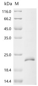 Bovine Transforming growth factor beta-1 proprotein (TGFB1), partial Recombinant Protein, Bos taurus (Bovine), E.coli, C-terminal 10xHis-tagged, 20.3 kDa, purity >≥ 85% as determined by SDS-PAGE.