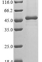 Human Melanoma-associated antigen B2 (MAGEB2) Recombinant Protein - BioCrest Sci