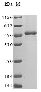 Human Melanoma-associated antigen B2 (MAGEB2) Recombinant Protein, Homo sapiens (Human), Mammalian cell, N-terminal 10xHis-tagged and C-terminal Myc-tagged, 40.3 kDa, purity >≥ 85% as determined by SDS-PAGE.