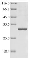 Human Neuronal acetylcholine receptor subunit alpha-7 (CHRNA7), partial Recombinant Protein, N-His - BioCrest Sci