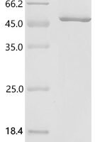 Bovine Lactadherin (MFGE8) Recombinant Protein - BioCrest Sci