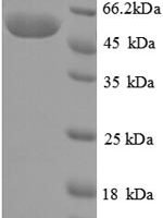 Pseudomonas putida Creatinine amidohydrolase (crnA) Recombinant Protein - BioCrest Sci