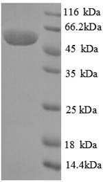 Pseudomonas putida Creatinine amidohydrolase (crnA) Recombinant Protein, Pseudomonas putida (Arthrobacter siderocapsulatus), E.coli, N-terminal GST-tagged, 55.6 kDa, purity >≥ 90% as determined by SDS-PAGE.
