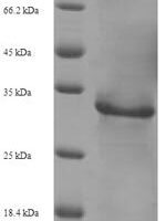 Human immunodeficiency virus type 2 subtype A Protein Vpx (vpx) Recombinant Protein, N-His-SUMO - BioCrest Sci