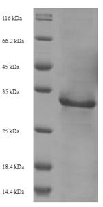 Human immunodeficiency virus type 2 subtype A Protein Vpx (vpx) Recombinant Protein, N-His-SUMO, Human immunodeficiency virus type 2 subtype A (isolate ROD) (HIV-2), E.coli, N-terminal 6xHis-SUMO-tagged, 28.8 kDa, purity >≥ 90% as determined by SDS-PAGE.