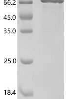 Human TP53 & S100P Heterodimer Protein Recombinant Protein - BioCrest Sci