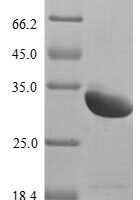 Rat Sclerostin domain-containing protein 1 (Sostdc1) Recombinant Protein, N-10His/C-Myc, aa 24–206, Yeast - BioCrest Sci