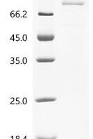 Mouse eIF5-mimic protein 2 (Bzw1) Recombinant Protein, C-hFc1 - BioCrest Sci