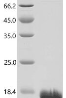 Human Polyubiquitin-B (UBB), partial Recombinant Protein - BioCrest Sci