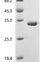 Helicobacter pylori Vacuolating cytotoxin autotransporter (vacA), partial Recombinant Protein, C-His, aa 37–245 - BioCrest Sci