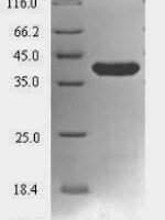 Mycoplasma pneumoniae Lon protease (lon), partial Recombinant Protein - BioCrest Sci