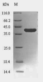 Mycoplasma pneumoniae Lon protease (lon), partial Recombinant Protein, Mycoplasma pneumoniae (strain ATCC 29342 / M129), E.coli, N-terminal 6xHis-SUMO-tagged, 39.8 kDa, purity >≥ 90% as determined by SDS-PAGE.