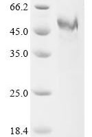 Human Inter-alpha-trypsin inhibitor heavy chain H5 (ITIH5) , partial Recombinant Protein - BioCrest Sci