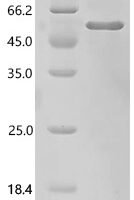 Drosophila melanogaster F-box-like/WD repeat-containing protein ebi (ebi), partial Recombinant Protein - BioCrest Sci