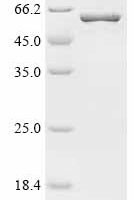 Human Matrix metalloproteinase-25 (MMP25) Recombinant Protein - BioCrest Sci