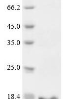 Aspidelaps scutatus Cytotoxin homolog S3C2 Recombinant Protein, N-10His/C-Myc - BioCrest Sci