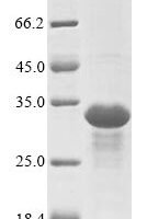 Epstein-Barr virus Epstein-Barr nuclear antigen 3 (EBNA3), partial Recombinant Protein - BioCrest Sci