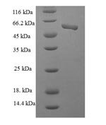 Human Casein kinase II subunit alpha' (CSNK2A2), partial Recombinant Protein, Homo sapiens (Human), E.coli, N-terminal 6xHis-SUMO-tagged, 56.7 kDa, purity >≥ 90% as determined by SDS-PAGE.
