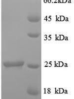 Rat Metalloproteinase inhibitor 1 (Timp1) Recombinant Protein - BioCrest Sci