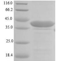 Human  Laminin subunit beta-1 (LAMB1), partial Recombinant Protein - BioCrest Sci