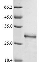 Schistosoma mansoni Antigenic integral membrane glycoprotein, partial Recombinant Protein - BioCrest Sci