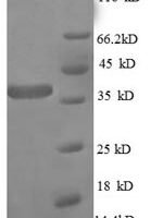 Escherichia coli 50S ribosomal protein L27 (rpmA) Recombinant Protein, N-GST - BioCrest Sci