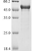 Rat Angiopoietin-1 (Angpt1) Recombinant Protein, C-His, aa 20–497, Mammalian cell - BioCrest Sci