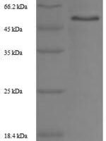 Rat Trophoblast glycoprotein (Tpbg), partial Recombinant Protein - BioCrest Sci