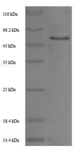 Rat Trophoblast glycoprotein (Tpbg), partial Recombinant Protein, Rattus norvegicus (Rat), E.coli, N-terminal 6xHis-SUMO-tagged, 51.8 kDa, purity >≥ 90% as determined by SDS-PAGE.