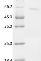 Human Kinesin-like protein KIF20B (KIF20B), partial Recombinant Protein - BioCrest Sci