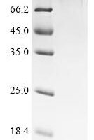 Human Cancer-associated gene 1 protein (CAGE1) Recombinant Protein - BioCrest Sci