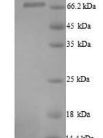 Human Protein-arginine deiminase type-1 (PADI1) Recombinant Protein, N-His, aa 1–663, Yeast - BioCrest Sci