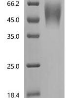 Human Potassium-transporting ATPase subunit beta (ATP4B), partial Recombinant Protein, N-10His - BioCrest Sci
