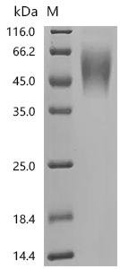 Human Potassium-transporting ATPase subunit beta (ATP4B), partial Recombinant Protein, N-10His, Homo sapiens (Human), Mammalian cell, N-terminal 10xHis-tagged, 30.2 kDa, purity >≥ 95% as determined by SDS-PAGE.
